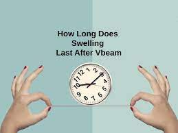 how long does swelling last after vbeam