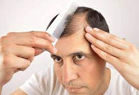 sertraline hair loss why it happens