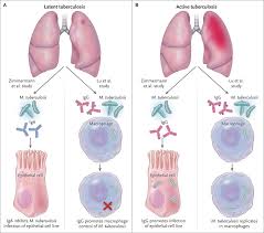 Tb is spread from person to person through the air. Antibodies To Mycobacterium Tuberculosis Nejm