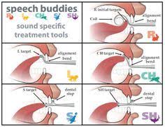 These Help Children Learn Correct Tongue Positioning For