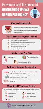 hemorrhoids piles during pregnancy