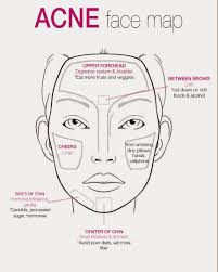 Face Mapping For Acne The Ultimate Guide