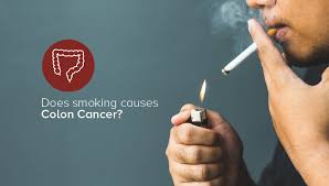 does smoking cause colon cancer