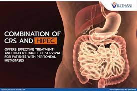 combination of crs and hipec offers