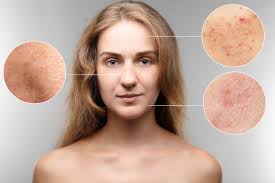 4 Most Common Skin Problems | Kessel Dermatology