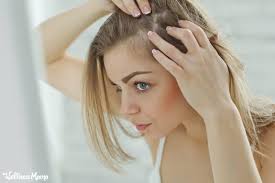 Ways to stop receding hair line. 11 Natural Remedies For Thinning Hair Wellness Mama