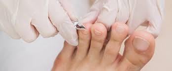 complete foot care by professionals