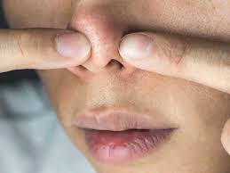 squeeze your nose pores