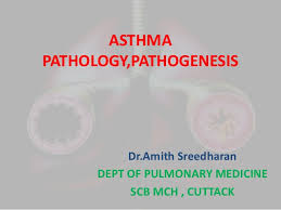 Asthma Pathogenesis
