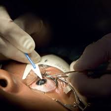 lasik eye surgery in dubai lasik eye