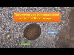 tapeworm eggs in human stool under the