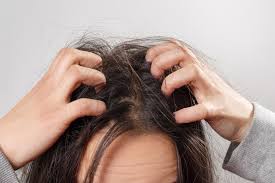 scalp inflammation and hair loss