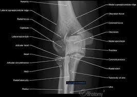 Medial epicondylitis is inflammation of the flexor pronator muscle mass originating at the medial epicondyle of the elbow. Elbow Radiography Anterior Posterior View Lateral Epicondyle Trochlea Of Humerus Coronoid Process Radiology Student Radiology Radiology Technologist