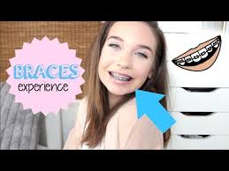 my braces experience you