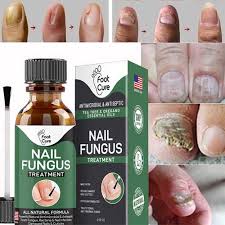 100 original nail fungus treatment