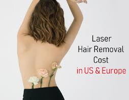 laser hair removal cost in us ca uk