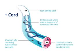 umbilical cord tissue stem cell storage
