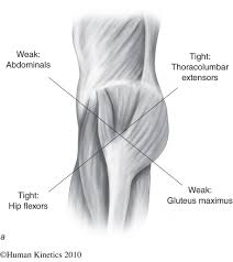 What exactly do your glutes do? Simple But Awesome Glute Activation Exercise Muscle Imbalance Hip Flexor Tight Hamstrings
