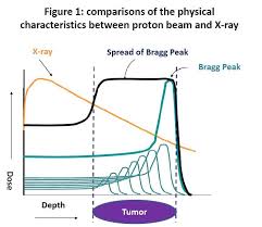 proton beam radiation therapy