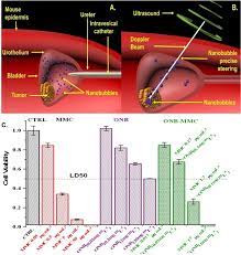 enhanced bladder cancer therapy