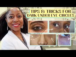 tricks for dark under eye circles