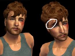 mod the sims 5 layerable wounds