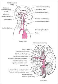 Hemorrhagic strokes (intracerebral and subarachnoid hemorrhage). Overview Of Stroke Neurologic Disorders Msd Manual Professional Edition