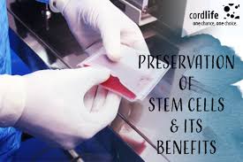 7 benefits of preserving stem cells