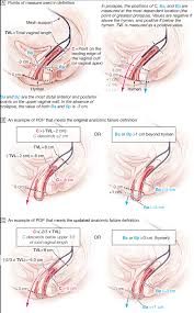 surgical repair of pelvic
