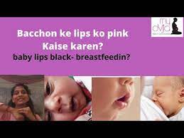 baby lips black after tfeeding lip