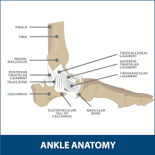ankle replacement surgery florida