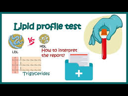 lipid profile test how to read report