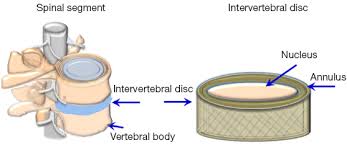 Image result for intervertebral disks