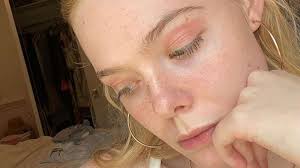 elle fanning embraces eczema in her