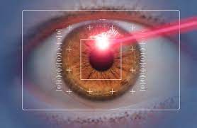 How is lasik eye surgery performed? Is There An Age Limit For Lasik Surgery Assil Eye Institute