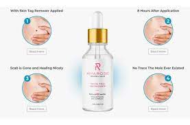 Amarose Skin Tag Remover Reviews: Worth It or Scam? Real Customer Results?