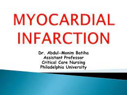 Understanding myocardial ischemia imbalance 20. Myocardial Infarction Ppt Video Online Download