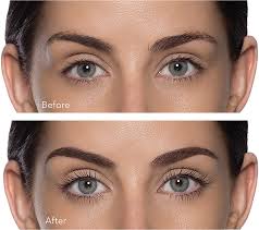 a lash lift