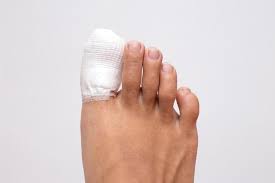 identifying when your ingrown toenail