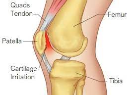knee pain from running causes