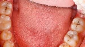 How to remove teeth stains. Best Dentist Bangor Me Blog The Worst Drinks For Your Teeth