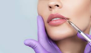 how long do dermal lip fillers last