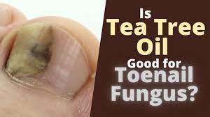 how to use tea tree oil for toenail fungus