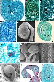 Ovule development in pistillate (a–i) and staminate (j–l) flowers. a... |  Download Scientific Diagram