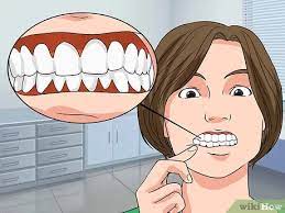 Simple methods of how to strengthen the gums at home, known to many. How To Strengthen Teeth And Gums With Pictures Wikihow