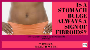 Womens Health Week If You Notice A Stomach Bulge Could It