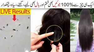 lice in hair 100 removal remes also