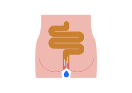 mucus discharge understanding