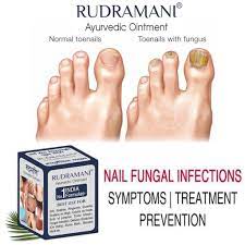 nail fungus infections treatment