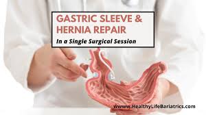 hiatal hernia repair sleeve